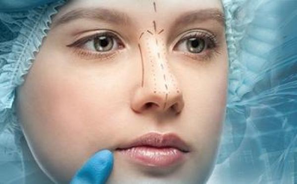 After Nose Operation